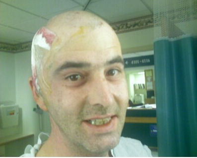 David right after surgery